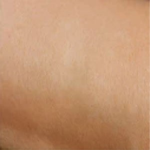 after-scar.png